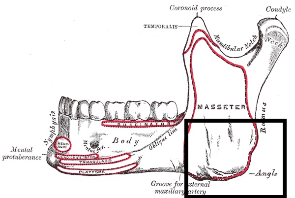 Engraving of a human lower jawbone from the side, with the angle of the mandible outlined by a black box and the masseter muscle attachment marked in red