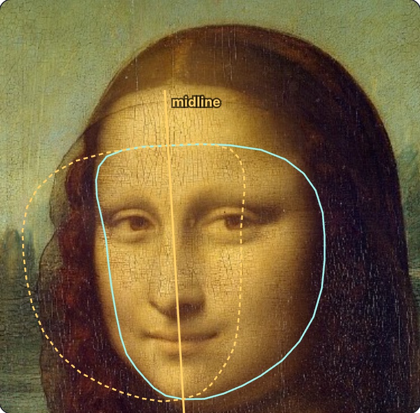 The Mona Lisa with the FaceCheckup symmetry layer: a yellow midline and a dashed mirrored face outline offset to one side